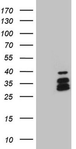 DLX4 Monoclonal Antibody (OTI8A1), TrueMAB , OriGene 100 &mu;L; Unconjugated:Antibodies,