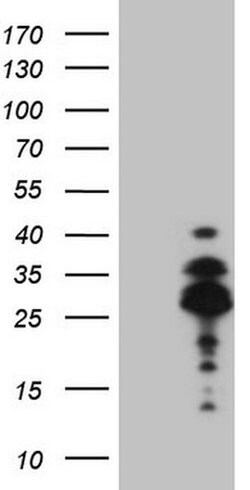 DLX4 Monoclonal Antibody (OTI7C8), TrueMAB , OriGene:Antibodies:Primary