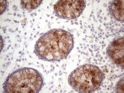 DMRT1 Monoclonal Antibody (OTI4E12), TrueMAB , OriGene 100 &mu;L; Unconjugated:Antibodies,
