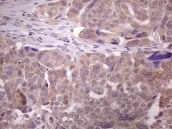 DMRT1 Mouse anti-Human, Clone: OTI2H1, lyophilized, TrueMAB 100 &mu;g;