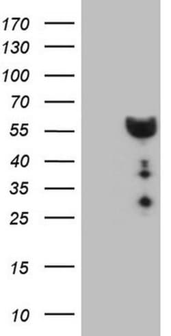 DMRT1 Monoclonal Antibody (OTI4B5), TrueMAB , OriGene 100 &mu;L; Unconjugated:Antibodies,