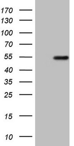 DMRT1 Monoclonal Antibody (OTI4E12), TrueMAB , OriGene 100 &mu;L; Unconjugated:Antibodies,