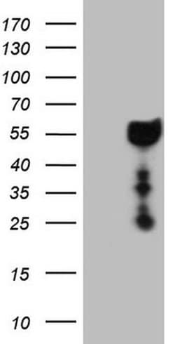 DMRT1 Monoclonal Antibody (OTI2H1), TrueMAB , OriGene 30 &mu;L; Unconjugated:Antibodies,