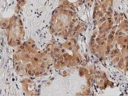 DNAJA2 Mouse anti-Canine, Human, Rat, Clone: OTI1G3, lyophilized, TrueMAB