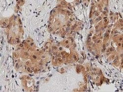 DNAJA2 Monoclonal Antibody (OTI1G3), TrueMAB , OriGene:Antibodies:Primary