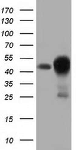 DNAJA2 Monoclonal Antibody (OTI3A11), TrueMAB , OriGene 30 &mu;L; Unconjugated:Antibodies,
