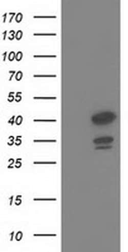 DNAJB1 Monoclonal Antibody (OTI1A12), TrueMAB , OriGene 100 &mu;L; Unconjugated:Antibodies,