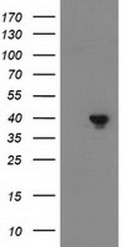 DNAJB1 Monoclonal Antibody (OTI1H8), TrueMAB , OriGene 100 &mu;L; Unconjugated:Antibodies,