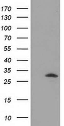 DNAJB2 Monoclonal Antibody (OTI5C11), TrueMAB , OriGene:Antibodies:Primary
