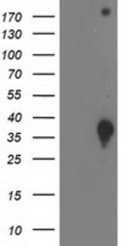DNAJB2 Mouse anti-Human, Clone: OTI4D12, lyophilized, TrueMAB 100 &mu;g;