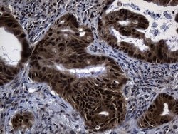 DNAJB6 Mouse anti-Human, Mouse, Rat, Clone: OTI5B5, lyophilized, TrueMAB