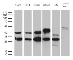 DNAJB6 Mouse anti-Human, Mouse, Rat, Clone: OTI2F10, lyophilized, TrueMAB