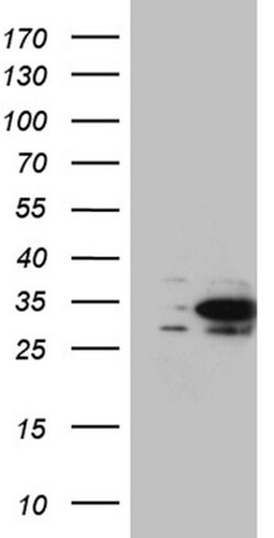 DNAJB6 Monoclonal Antibody (OTI3H4), TrueMAB , OriGene 100 &mu;L; Unconjugated:Antibodies,