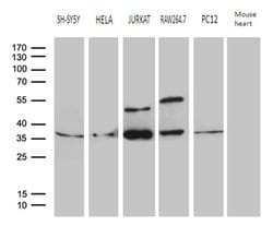DNAJB6 Monoclonal Antibody (OTI3H4), TrueMAB , OriGene 100 &mu;L; Unconjugated:Antibodies,
