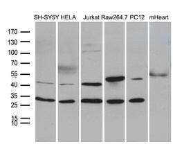 DNAJB6 Mouse anti-Human, Mouse, Rat, Clone: OTI5B5, lyophilized, TrueMAB