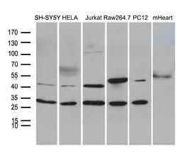 DNAJB6 Mouse anti-Human, Mouse, Rat, Clone: OTI5B5, liquid, TrueMAB 100