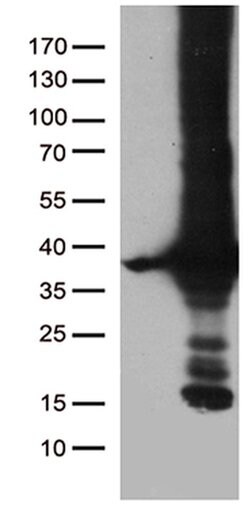 DNAJC27 Monoclonal Antibody (OTI8A10), TrueMAB , OriGene:Antibodies:Primary