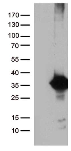 DNAJC27 Monoclonal Antibody (OTI9H3), TrueMAB , OriGene 30 &mu;L | Buy Online | Origene Technologies | Fisher Scientific