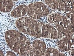 DNM1L Monoclonal Antibody (OTI1C1), TrueMAB , OriGene:Antibodies:Primary