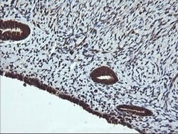 DNM1L Monoclonal Antibody (OTI1C1), TrueMAB , OriGene 100 &mu;L; Unconjugated:Antibodies,