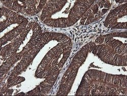 DNM1L Monoclonal Antibody (OTI1C1), TrueMAB , OriGene 100 &mu;L; Unconjugated:Antibodies,