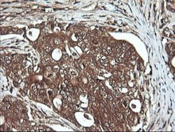 DNM1L Monoclonal Antibody (OTI1C1), TrueMAB , OriGene 100 &mu;L; Unconjugated:Antibodies,