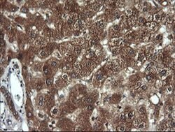 DNM1L Monoclonal Antibody (OTI1C1), TrueMAB , OriGene 100 &mu;L; Unconjugated:Antibodies,