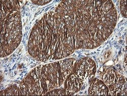 DNM1L Monoclonal Antibody (OTI4B5), TrueMAB , OriGene 100 &mu;L; Unconjugated:Antibodies,