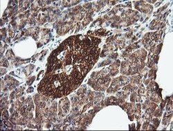 DNM1L Monoclonal Antibody (OTI4B5), TrueMAB , OriGene 100 &mu;L; Unconjugated:Antibodies,