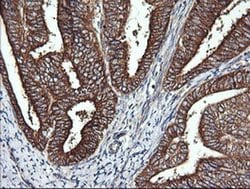 DNM1L Monoclonal Antibody (OTI4B5), TrueMAB , OriGene 100 &mu;L; Unconjugated:Antibodies,