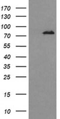 DNM1L Monoclonal Antibody (OTI3F3), TrueMAB , OriGene 100 &mu;L; Unconjugated:Antibodies,