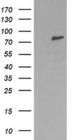 DNM1L Monoclonal Antibody (OTI4B5), TrueMAB , OriGene 100 &mu;L; Unconjugated:Antibodies,