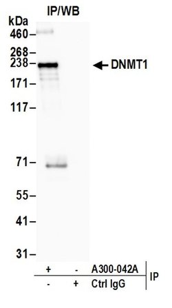 DNMT1 Rabbit anti-Human, Polyclonal, Bethyl Laboratories 100 &mu;L; Unconjugated:Antibodies,