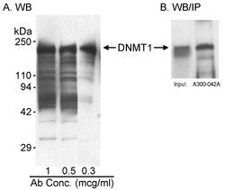 DNMT1 Rabbit anti-Human, Polyclonal, Bethyl Laboratories 100 &mu;L; Unconjugated:Antibodies,