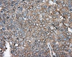 DNTTIP1 Monoclonal Antibody (OTI1F4), TrueMAB , OriGene 30 &mu;L; Unconjugated:Antibodies,