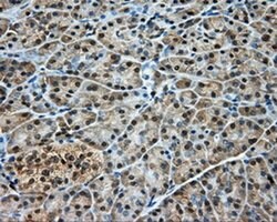 DNTTIP1 Monoclonal Antibody (OTI1F4), TrueMAB , OriGene 30 &mu;L; Unconjugated:Antibodies,