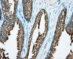 DNTTIP1 Monoclonal Antibody (OTI1F4), TrueMAB , OriGene 30 &mu;L; Unconjugated:Antibodies,