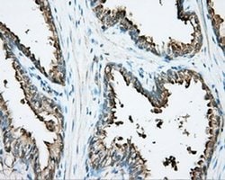 DNTTIP1 Monoclonal Antibody (OTI1F4), TrueMAB , OriGene:Antibodies:Primary