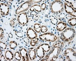 DNTTIP1 Monoclonal Antibody (OTI1F4), TrueMAB , OriGene 30 &mu;L; Unconjugated:Antibodies,
