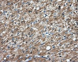 DNTTIP1 Monoclonal Antibody (OTI1F4), TrueMAB , OriGene 30 &mu;L; Unconjugated:Antibodies,