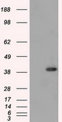 DNTTIP1 Monoclonal Antibody (OTI1F4), TrueMAB , OriGene 30 &mu;L; Unconjugated:Antibodies,