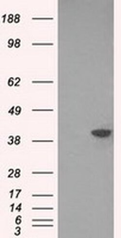DNTTIP1 Monoclonal Antibody (OTI1D3), TrueMAB , OriGene:Antibodies:Primary