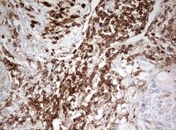 DOCK2 Mouse anti-Human, Clone: OTI7G2, lyophilized, TrueMAB 100 &mu;g;