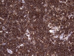 DOCK2 Monoclonal Antibody (OTI4E12), TrueMAB , OriGene:Antibodies:Primary