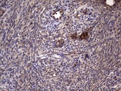 DOCK8 Mouse anti-Human, Clone: OTI4H10, lyophilized, TrueMAB 100 &mu;g;