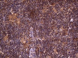 DOCK8 Mouse anti-Human, Clone: OTI4H10, lyophilized, TrueMAB 100 &mu;g;