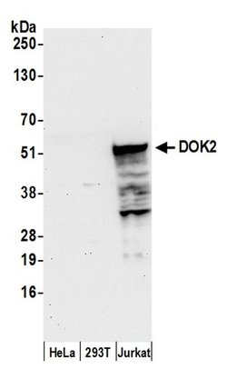 DOK2 Polyclonal Antibody, Bethyl Laboratories 20 &mu;L | Buy Online | Bethyl Laboratories, Inc | Fisher Scientific