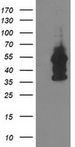 DOK2 Monoclonal Antibody (OTI1A4), TrueMAB , OriGene 100 &mu;L; Unconjugated:Antibodies,