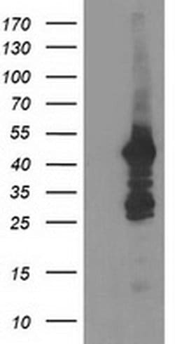 DOK2 Monoclonal Antibody (OTI2A3), TrueMAB , OriGene 100 &mu;L; Unconjugated:Antibodies,