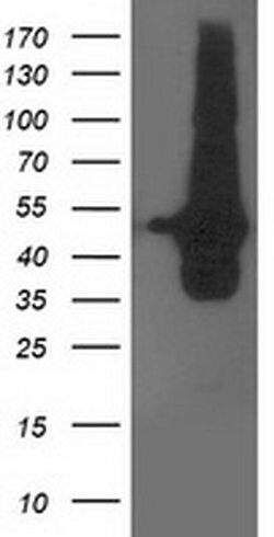 DOK2 Monoclonal Antibody (OTI3D6), TrueMAB , OriGene 100 &mu;L; Unconjugated:Antibodies,